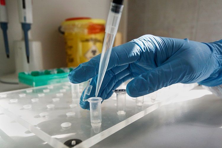 Иранские ученые создали нанотест, способный выявить коронавирус за полминуты