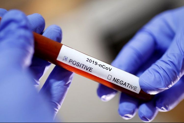 Number of people infected with coronavirus in Georgia reaches 671