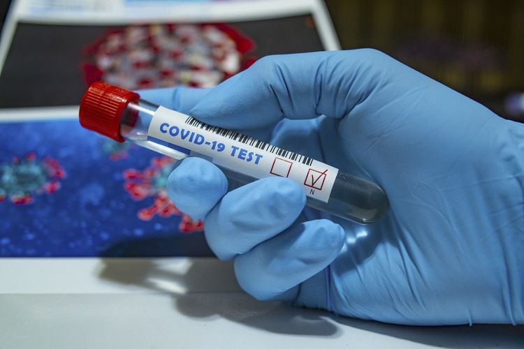 TABIB: Coronavirus infection recorded among officers in Azerbaijan