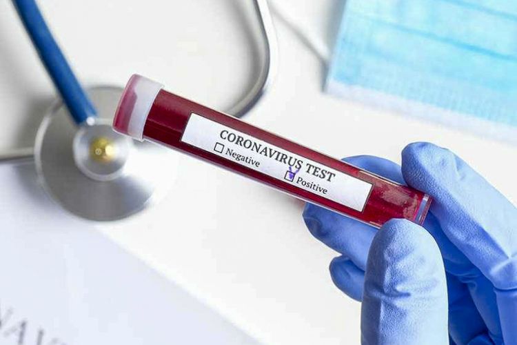 Braziliyada son sutkada koronavirusdan 824 nəfər ölüb
