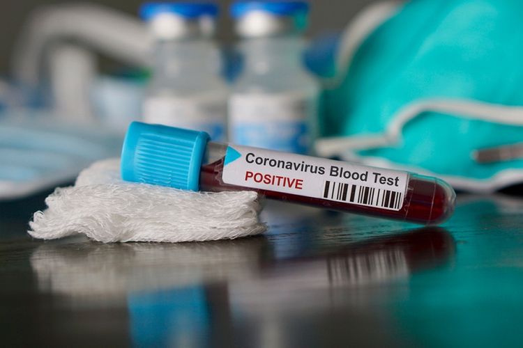 Kazakhstan reports 311 coronavirus-infected patients over past day 