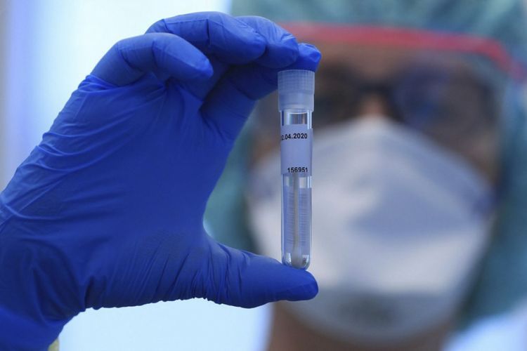 Iran to begin COVID-19 vaccine human test soon
