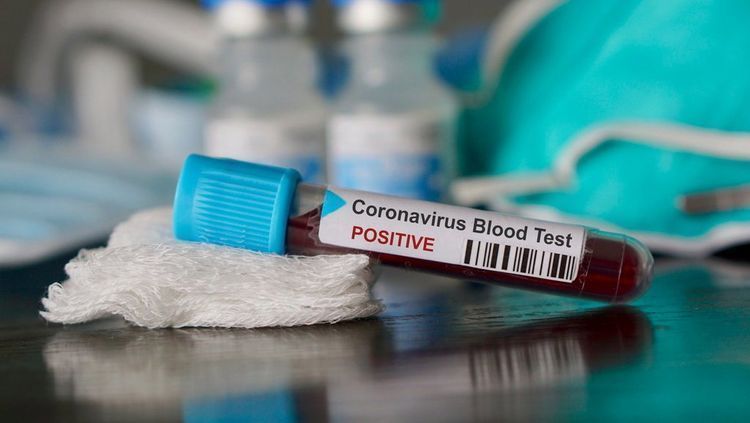 Number of confirmed coronavirus cases reaches 36,899 in Azerbaijan, 541 deaths