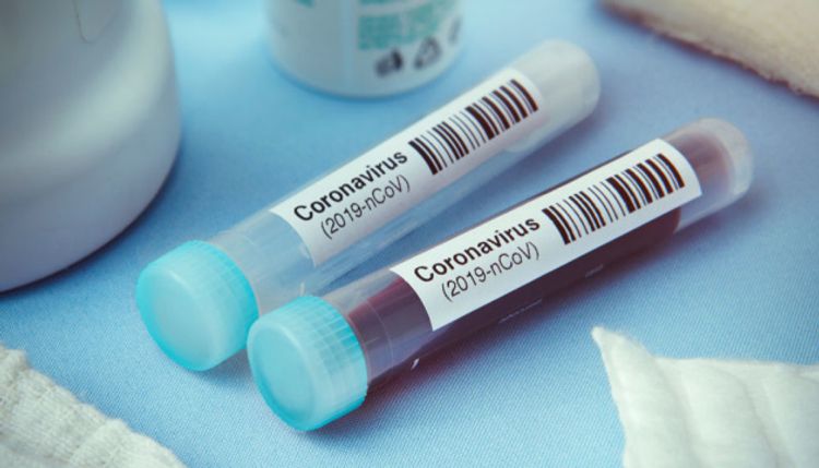 Ukraine reports 2,884 new coronavirus cases