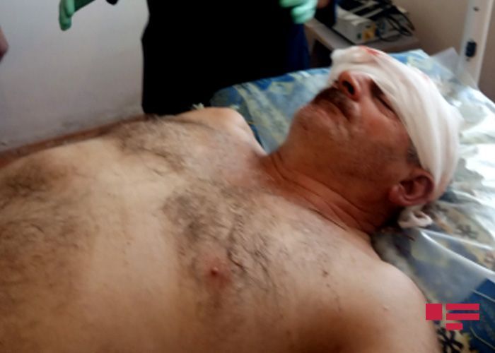 As a result of Armenian shelling in the Aghdam direction, Azerbaijani civilian wounded