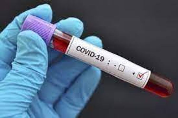  Number of confirmed coronavirus cases reaches 271 834 in Azerbaijan, 3,711 death cases