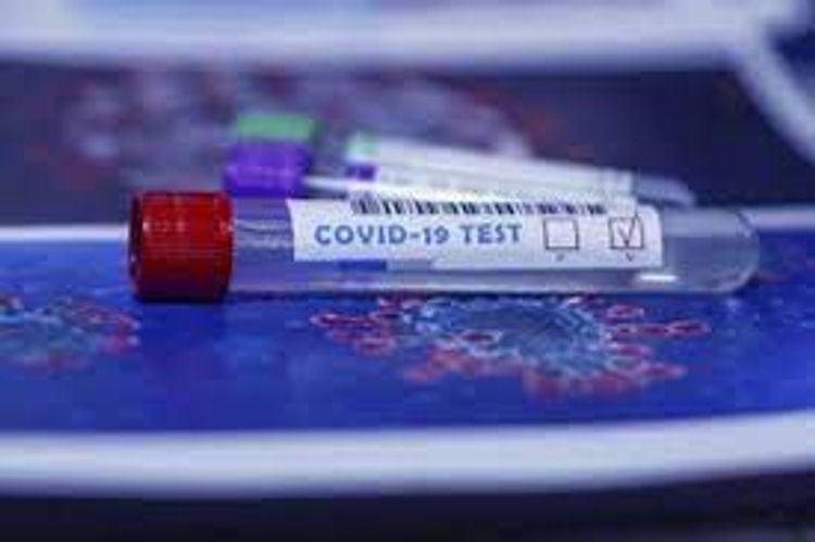 Number of confirmed coronavirus cases reaches 276 464 in Azerbaijan, 3,780 death cases