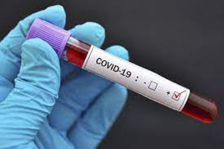 Number of confirmed coronavirus cases reaches 298522 in Azerbaijan, 4107 death cases