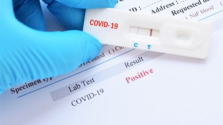 Number of confirmed coronavirus cases reaches 313006 in Azerbaijan, 4371 death cases