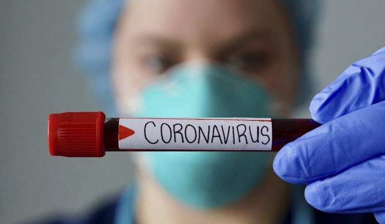 Число умерших от коронавируса в Армении достигло 3096 