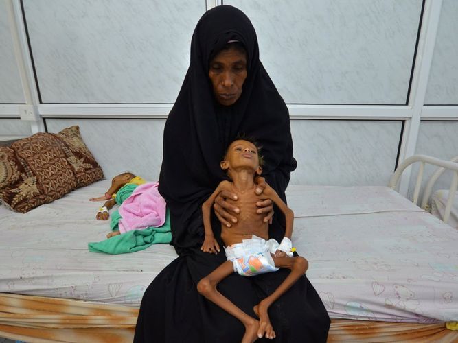 At least 400,000 Yemeni children under 5 could die of starvation this year