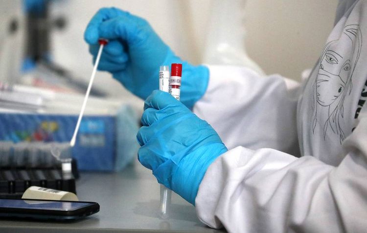 Rusiyada COVID-19-un “Britaniya ştammı”nı müəyyən edən ilk test sistemi qeydiyyatdan keçib