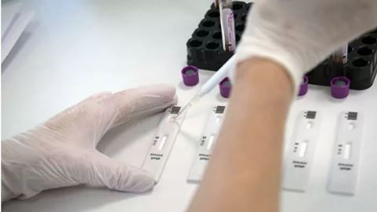 Britaniyada son sutka 323 nəfər koronavirusdan həyatını itirib