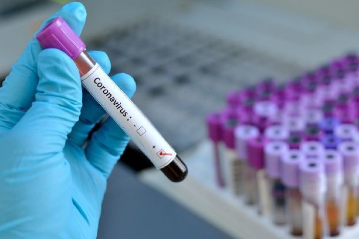 TƏBİB Azərbaycanda koronavirusun “Hindistan ştammı”nın qeydə alınıb-alınmadığına aydınlıq gətirib