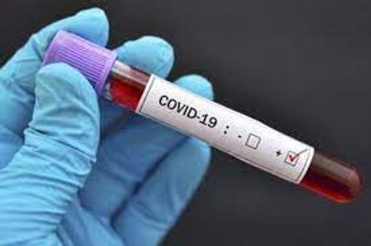  Number of confirmed coronavirus cases reaches 250 921 in Azerbaijan, 3,421 death cases