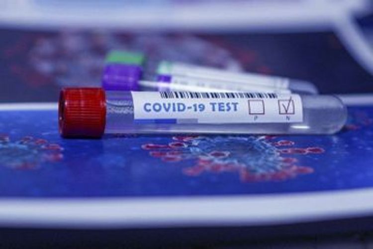 2816784 coronavirus tests conducted in Azerbaijan so far