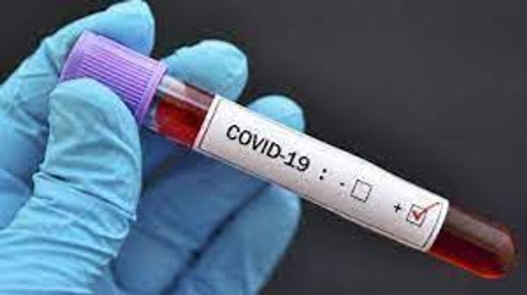 3 279 163 coronavirus tests conducted in Azerbaijan so far