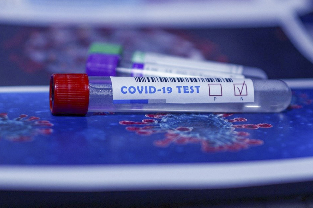 Koronavirus testi