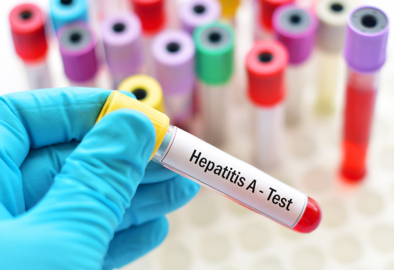 62 people died from hepatitis in Azerbaijan last year