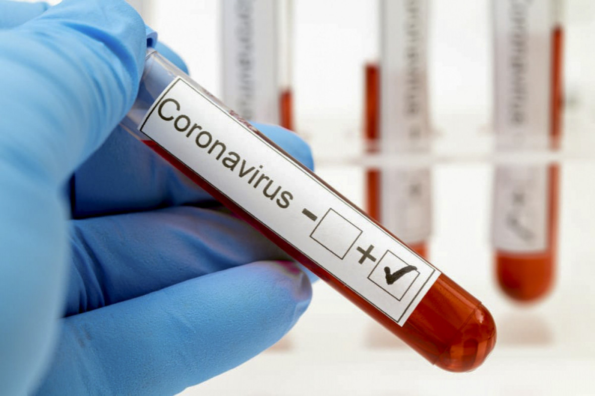 İranda daha 134 nəfər koronavirusdan ölüb