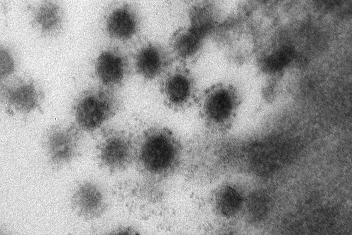 дельта-штамм коронавируса