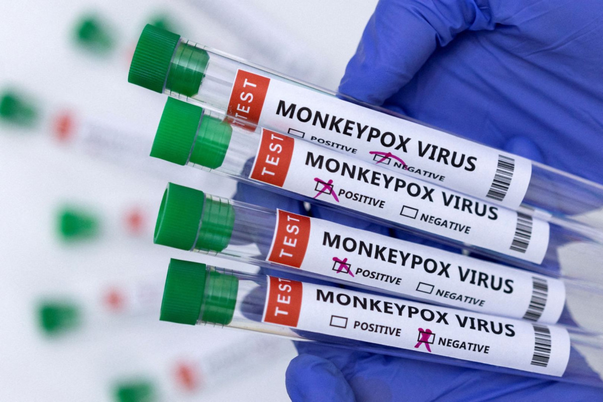 U.S. reports over 17,000 monkeypox cases