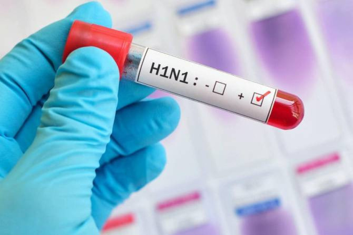 No swine flu case detected in Azerbaijan: Ministry of Health