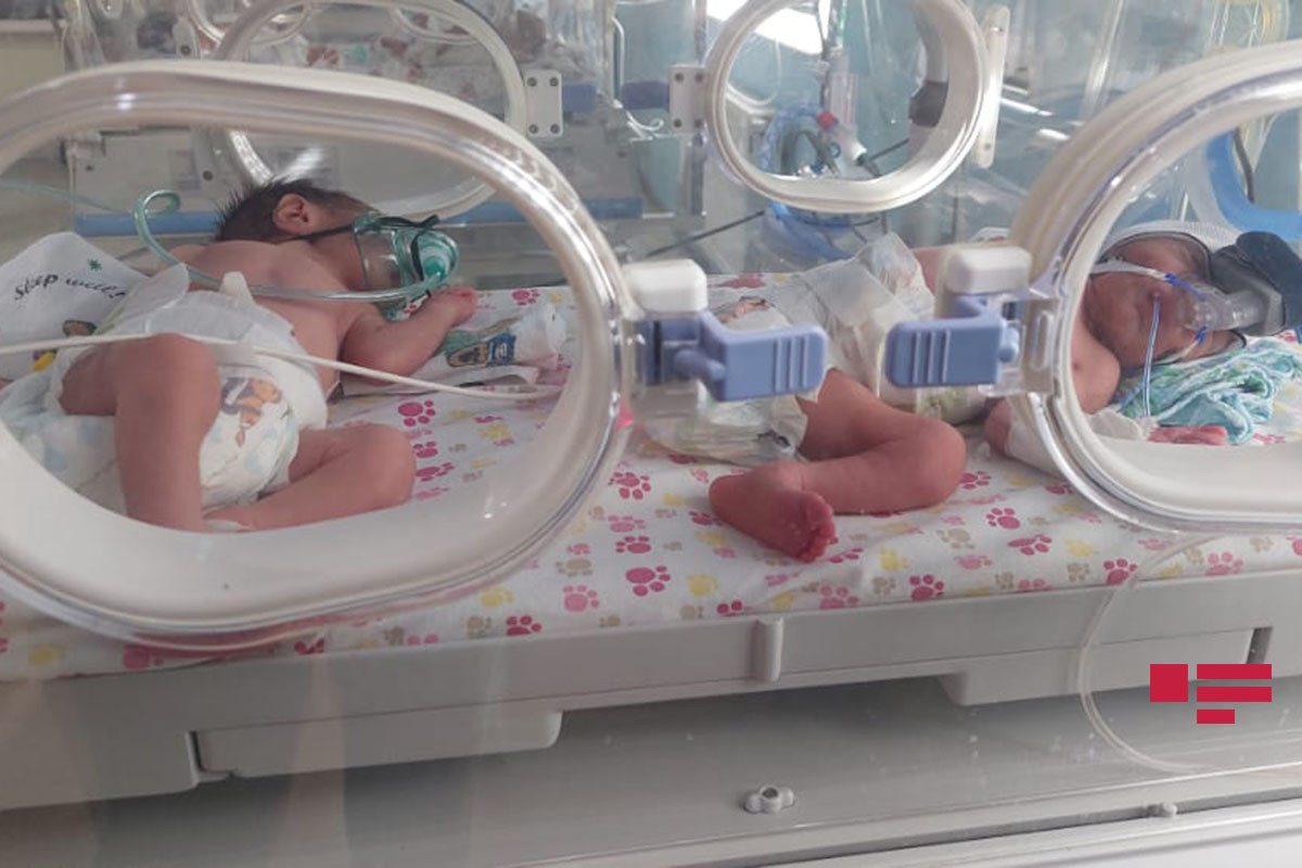 В Азербайджане первыми в новом году родились мальчики-близнецы