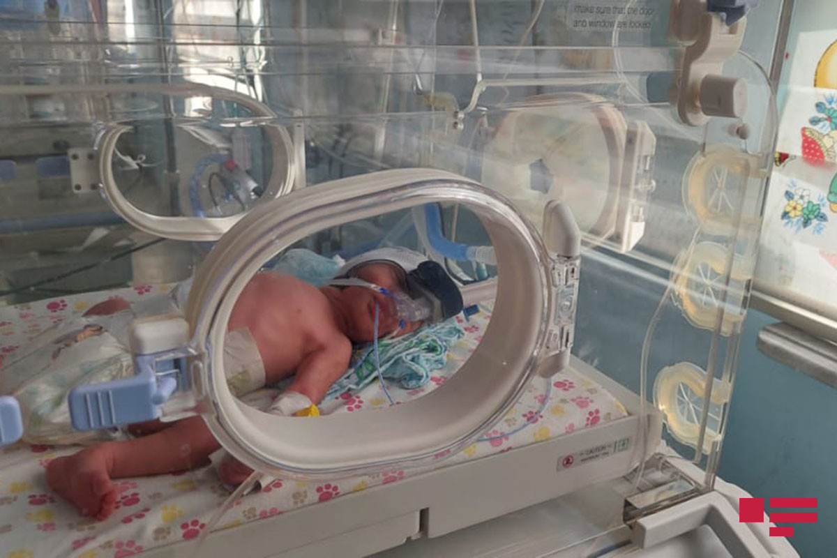 В Азербайджане первыми в новом году родились мальчики-близнецы