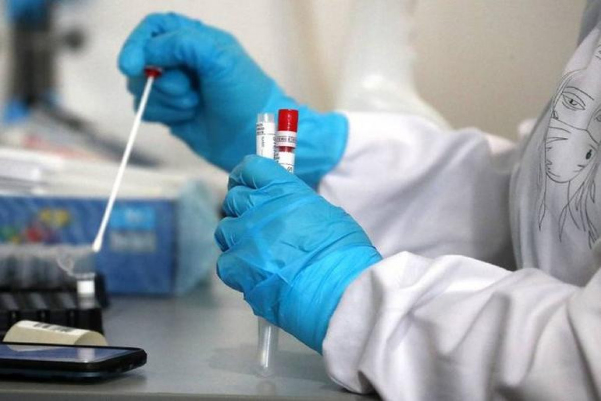 Rusiyada Omicron ştamını müəyyən edən test-sistemi qeydiyyatdan keçib