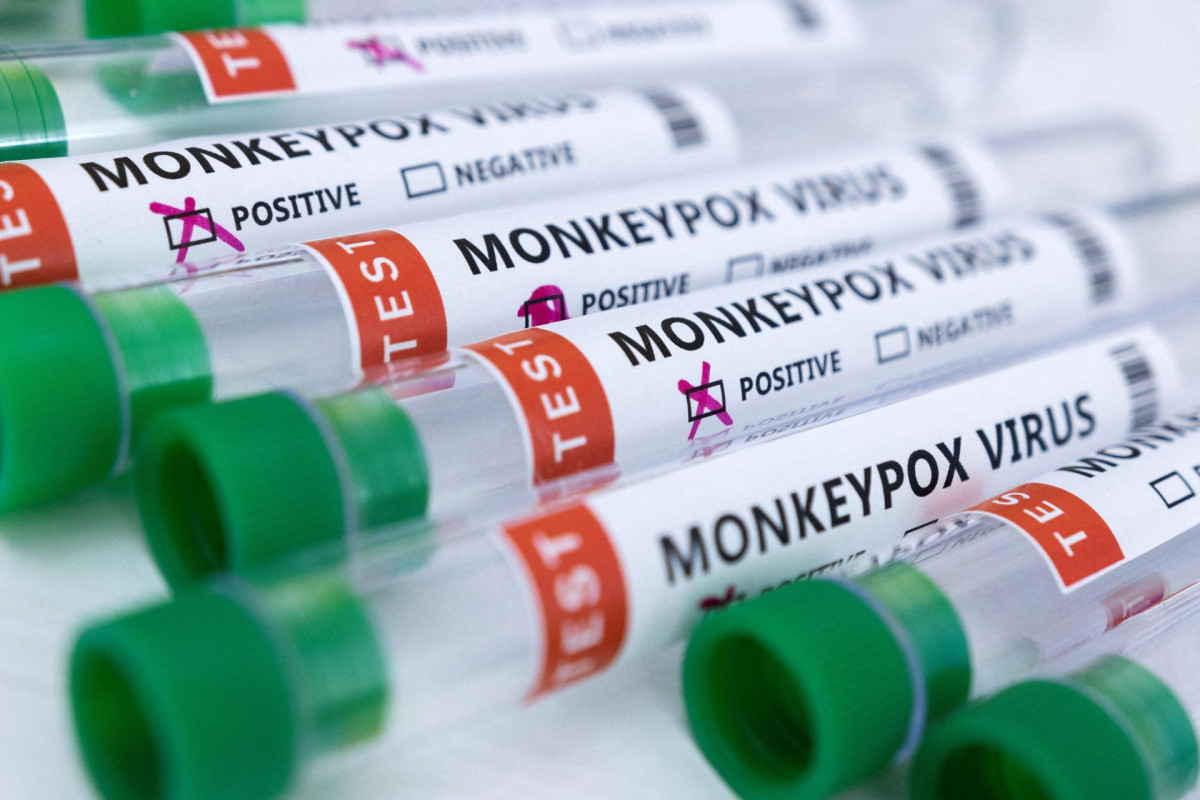 WHO declares monkeypox outbreak a public health emergency
