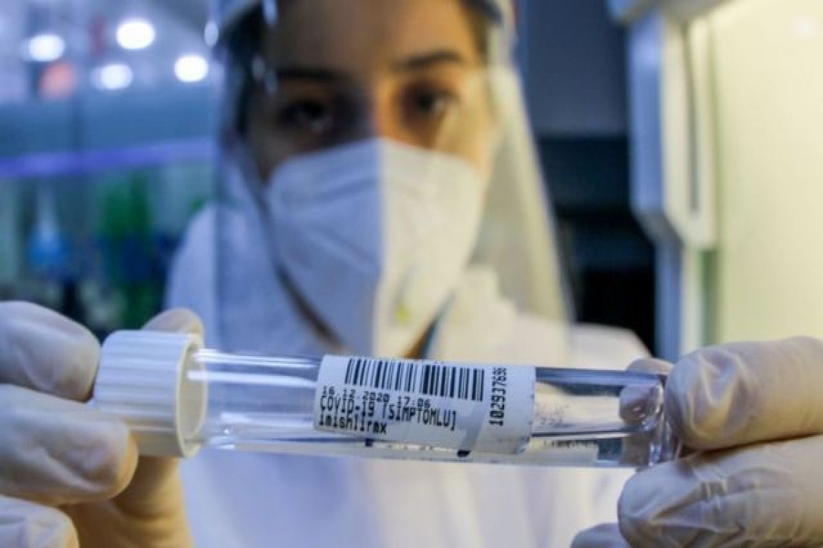 İranda koronavirusdan ölənlərin sayı 140 mini ötüb
