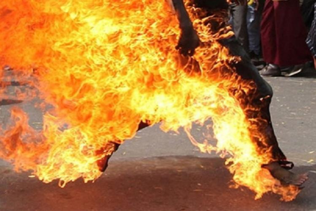 В Газахе гражданин Турции получил ожоги