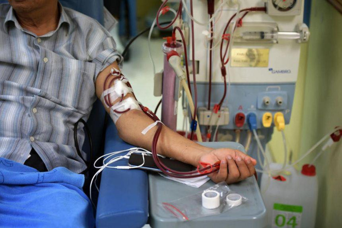 Ölkə üzrə dializ aparatlarının 10%-i istismar müddətini başa vurub