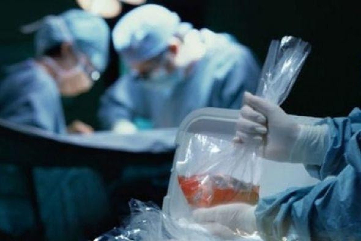 Azərbaycanda meyitdən orqan köçürülməsi sahəsindəki problemlər açıqlanıb