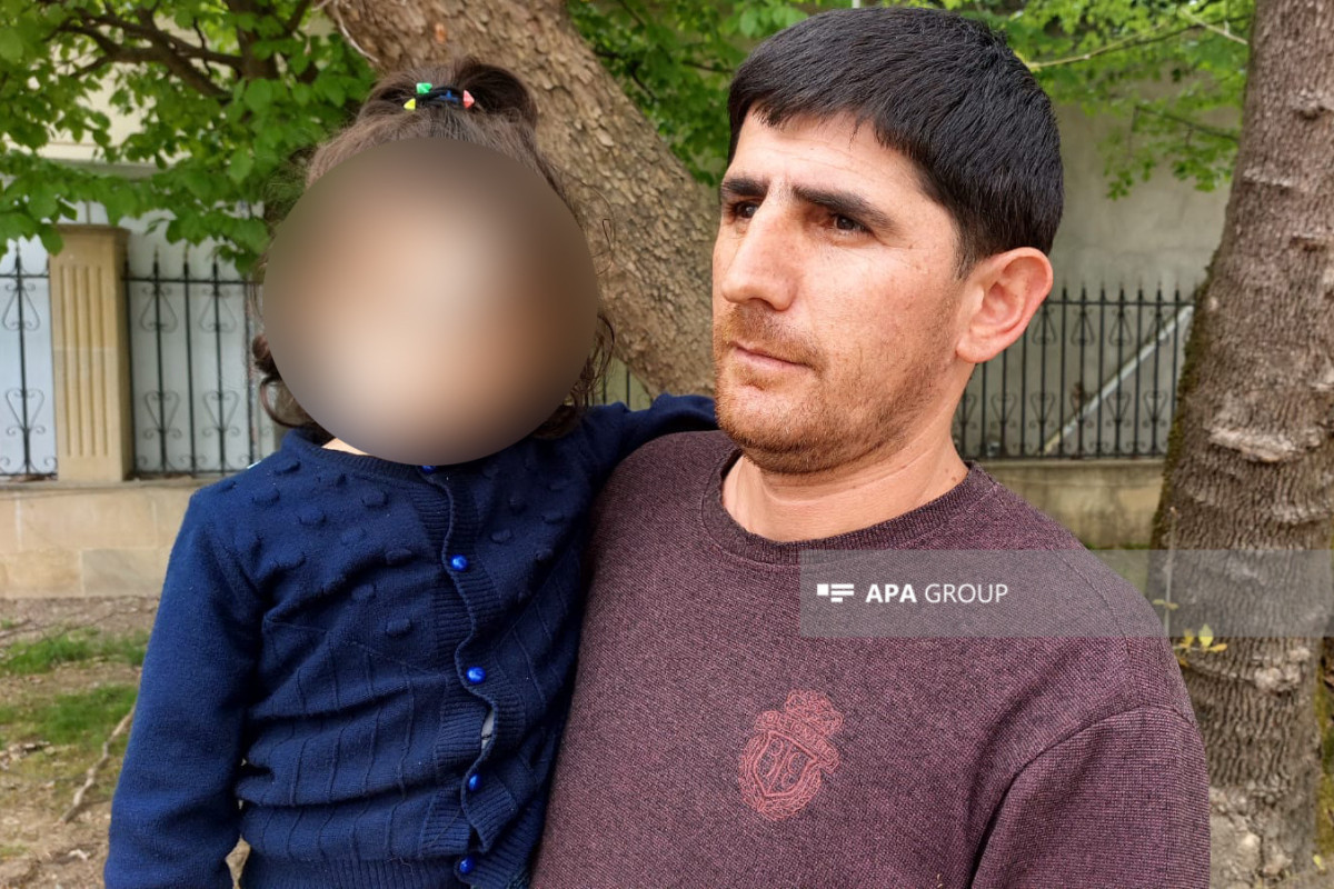 Astarada 4 yaşlı uşağı it dişləyib - FOTO 