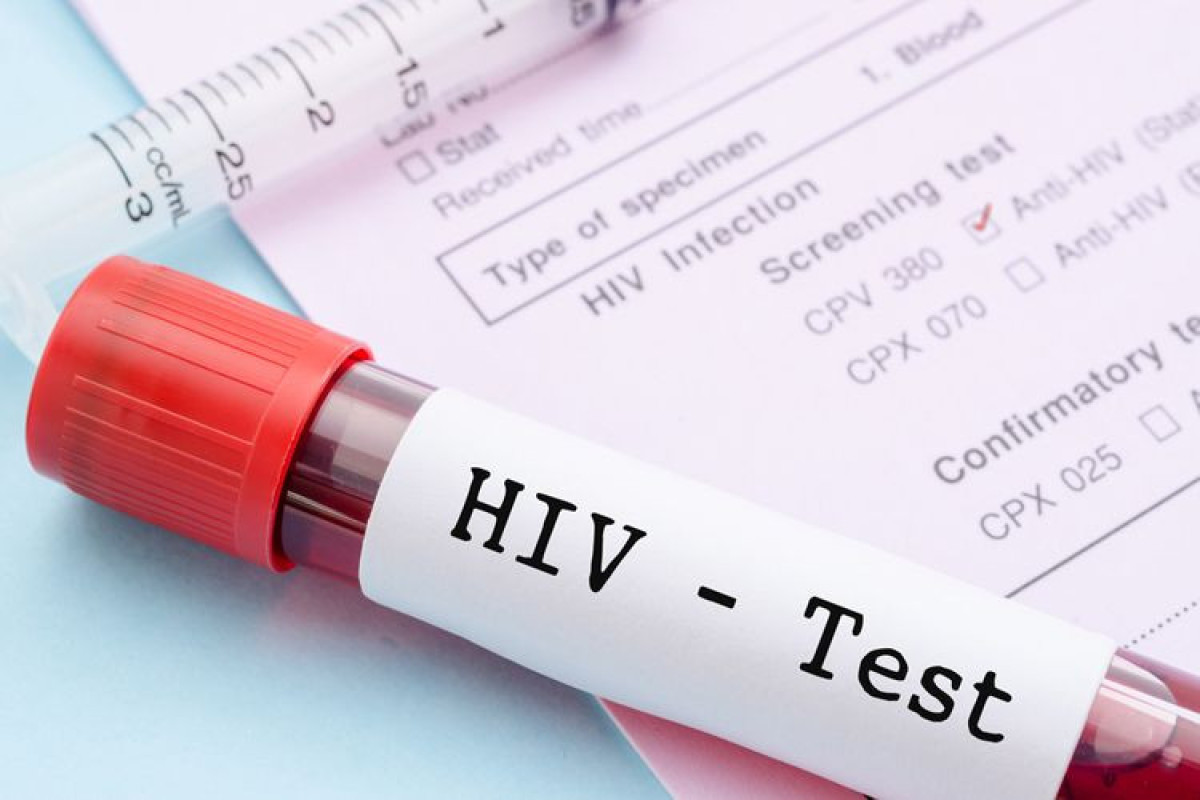 Обнародовано количество ВИЧ-инфицированных в Азербайджане
