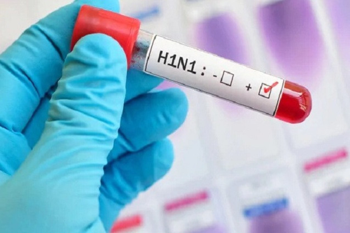 Минздрав: Эпидемиологическая ситуация в связи со свиным гриппом контролируется