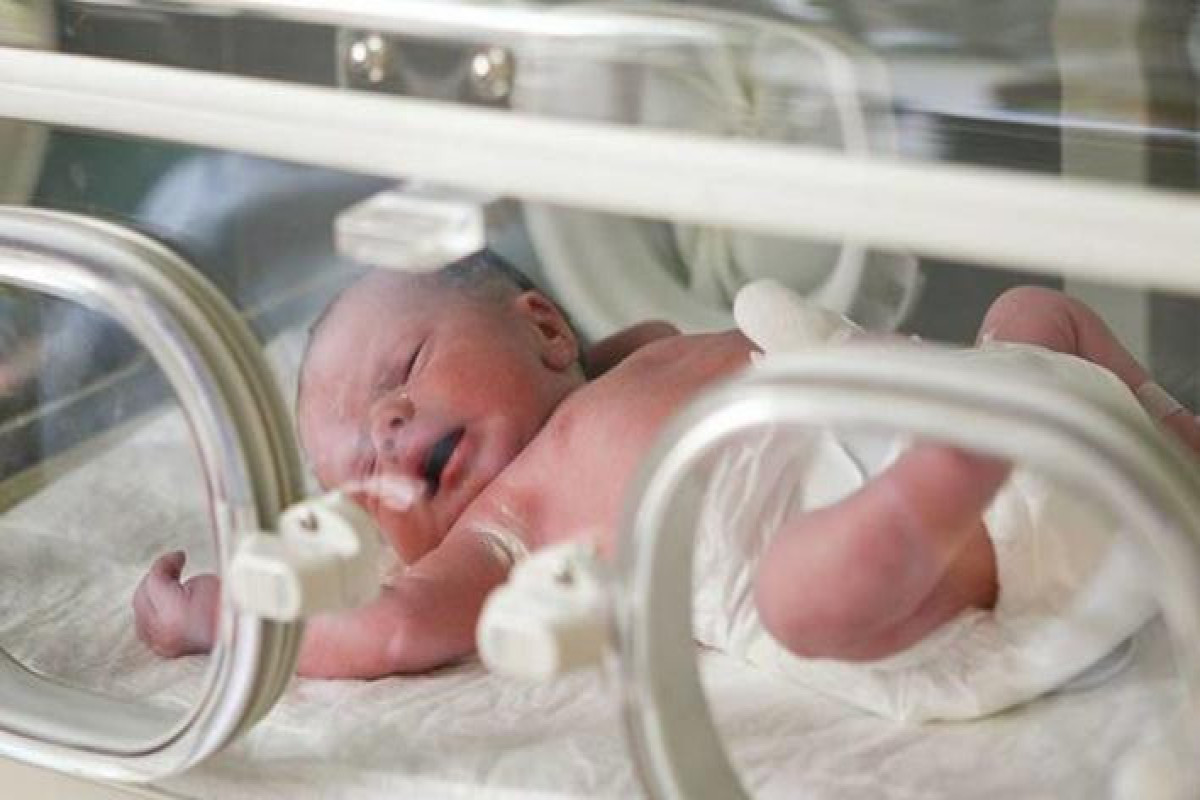Hər il 15 milyon körpə vaxtından əvvəl doğulur