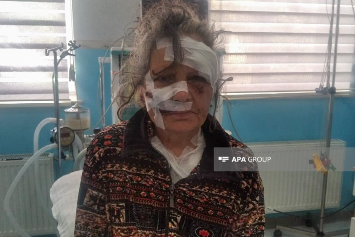 İsmayıllıda 67 yaşlı qadına itlər hücum edib - FOTO 