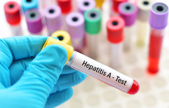 SN: Mingəçevirdə uşaqlar arasında tək-tək hallarda Hepatit A xəstəliyi qeydə alınıb