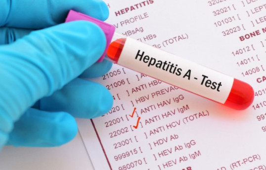 SN: 5-14 yaş qrupu uşaqlar Hepatit A virusuna daha çox yoluxur