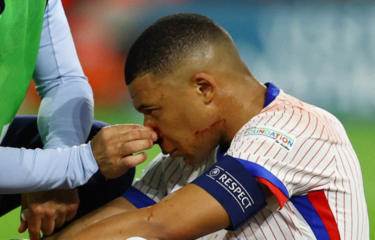 Avstriya ilə oyunda burnu sınan Mbappe AVRO-2024-ün qrup mərhələsini buraxacaq