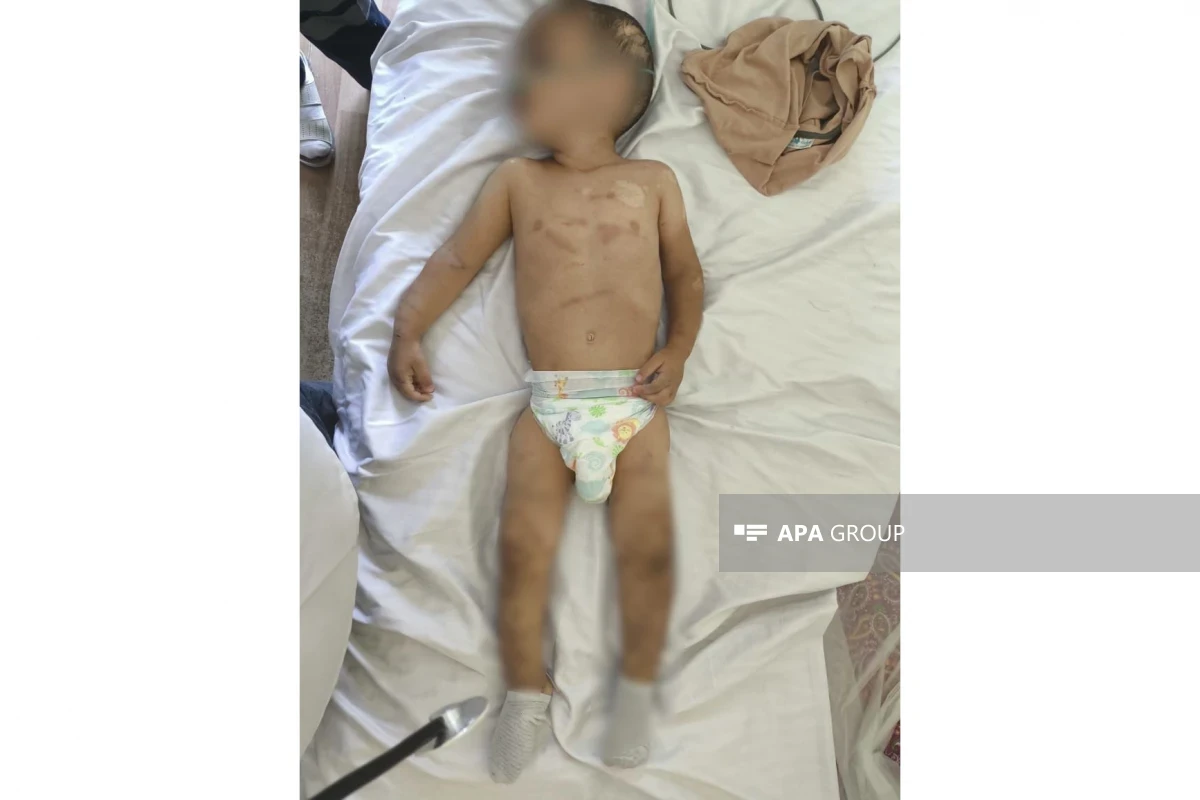 Ağdamda daha əvvəl də işgəncə görən körpənin anasına verilməsinin səbəbi açıqlanıb