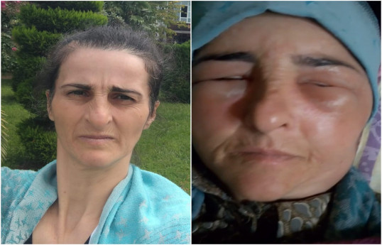 ​​​​​​​Lənkəranda qonşular arasında dava olub, xəsarət alan var