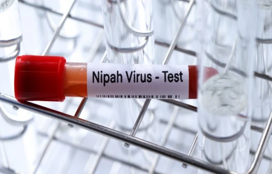 Gürcüstanda Nipah virusu aşkarlanmayıb