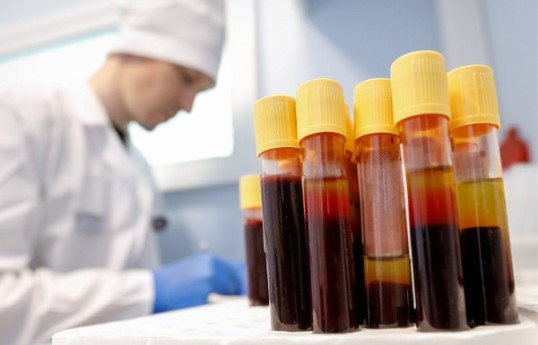 Rusiyanın 30 regionunda İİV ümumiləşdirilmiş epidemiya miqyasına qədər yayılıb